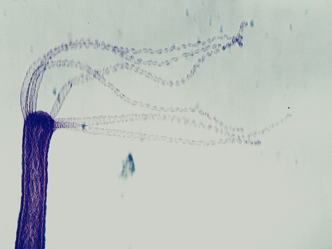 Hydra (genus)